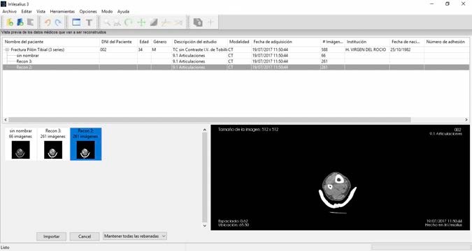 Ventana de importación de DICOM en InVesalius mostrando las series disponibles