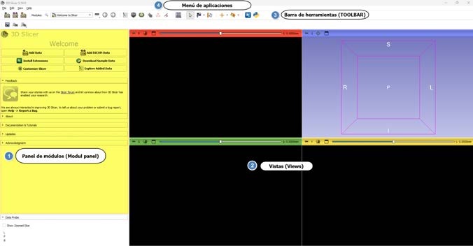 Pantalla de bienvenida de 3D Slicer con el panel de módulos y las vistas señaladas