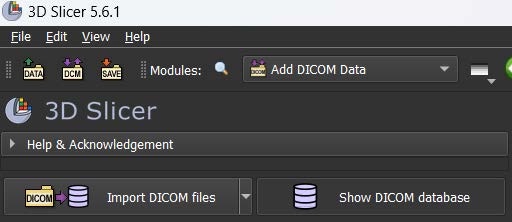 Barra de herramientas de 3D Slicer con la opción Import DICOM Data