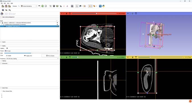 Botón Add para crear una nueva segmentación vacía en Segment Editor
