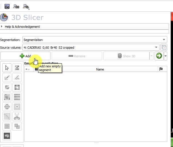Panel Segment Editor con el primer segmento creado