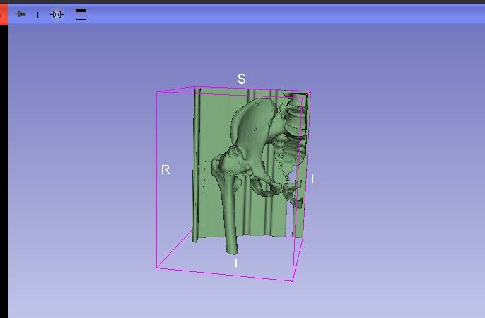 Resultado 3D tras aplicar la herramienta Threshold, con vistas 2D en verde