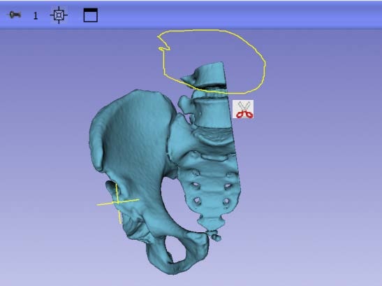 Herramienta Scissors recortando una zona del modelo 3D